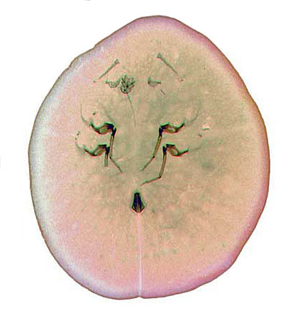   Kilifia deltoides  